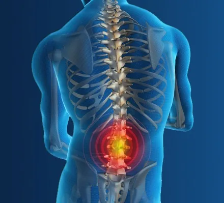 lower-back-pain